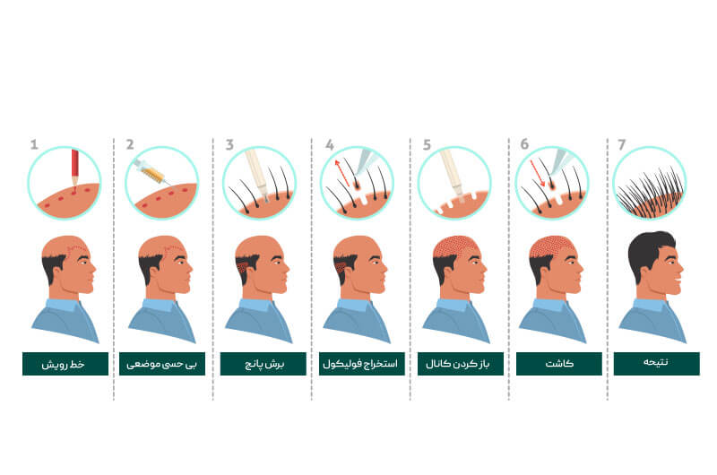 گرافت-مو-چیست؟